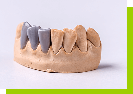 mosty stomatologiczne