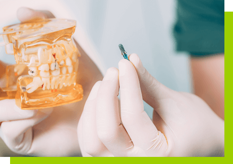 proteza całkowita na implantach