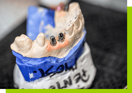 proteza na implantach