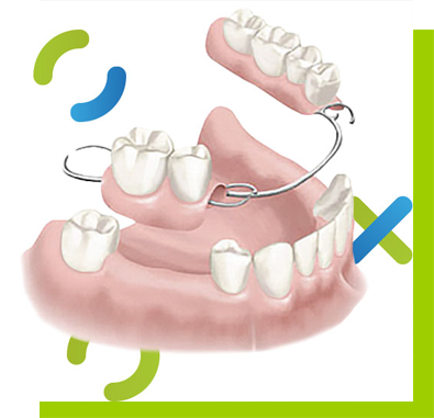 protetyka stomatologiczna łódź