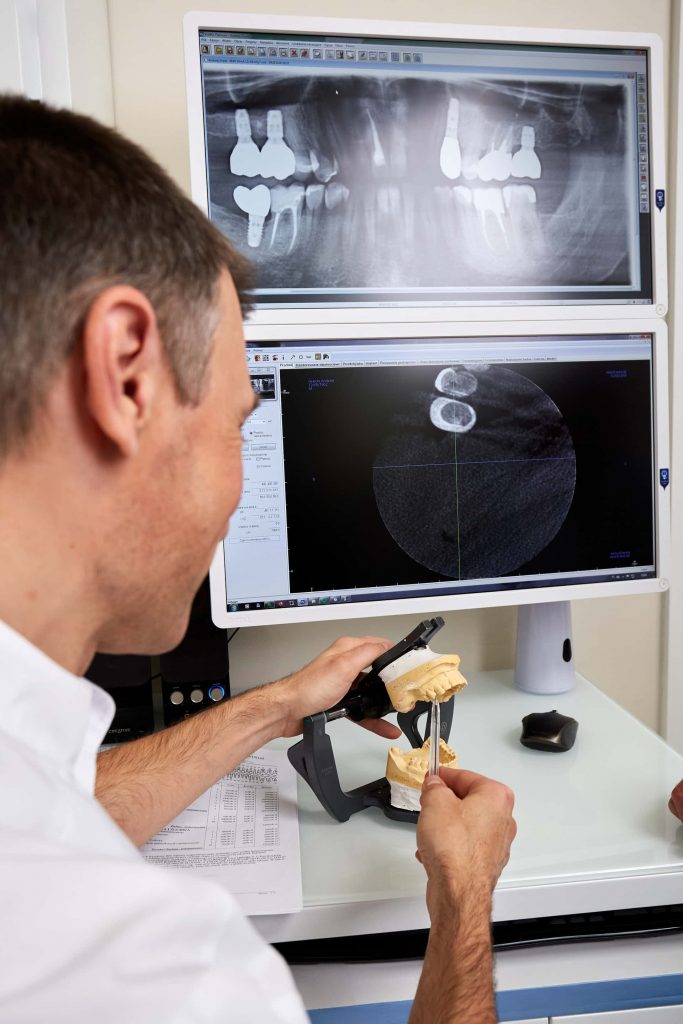 protetyka łódź opinie