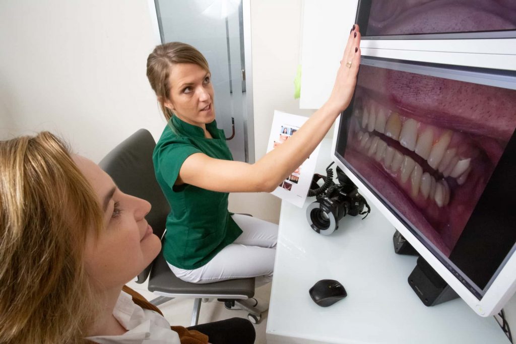 bonding zębów łódź